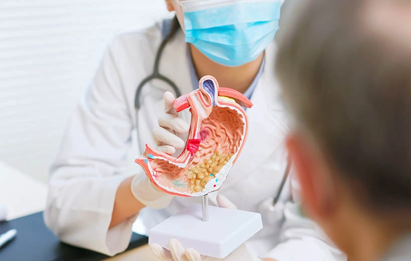 Рак желудка: симптомы, стадии, лечение, прогноз Рак желудка: симптомы, стадии, лечение, прогноз