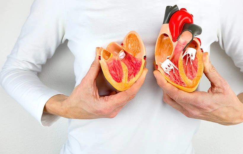 Кардиосклероз: причины, симптомы, лечение