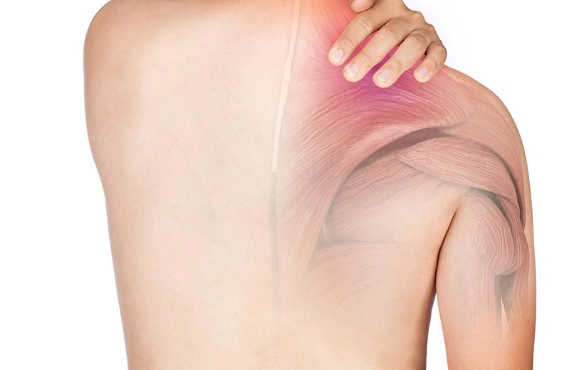 Полимиозит: симптомы и лечение