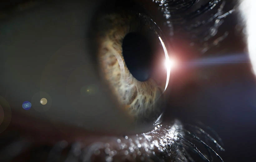 Отслоение сетчатки: причины, симптомы, лечение