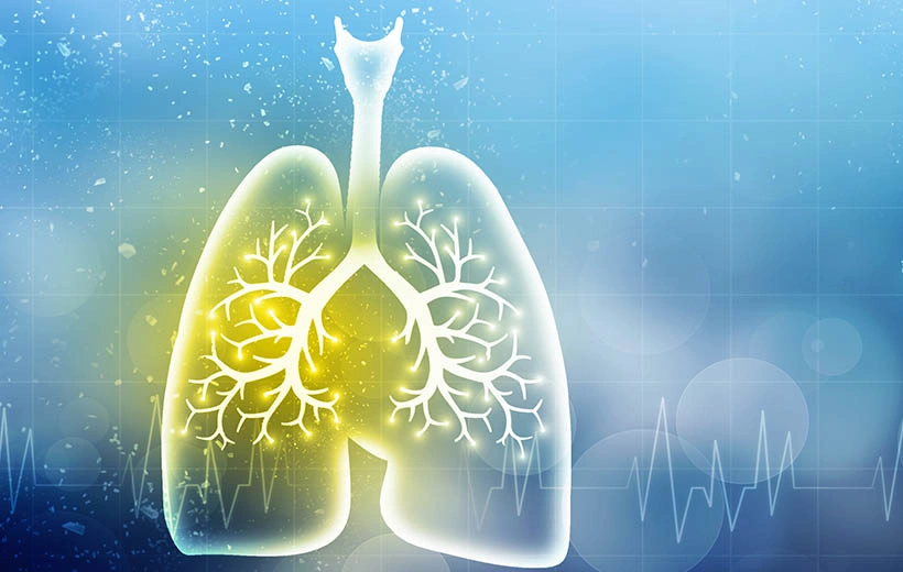 Саркоидоз легких: симптомы, стадии, лечение, прогноз