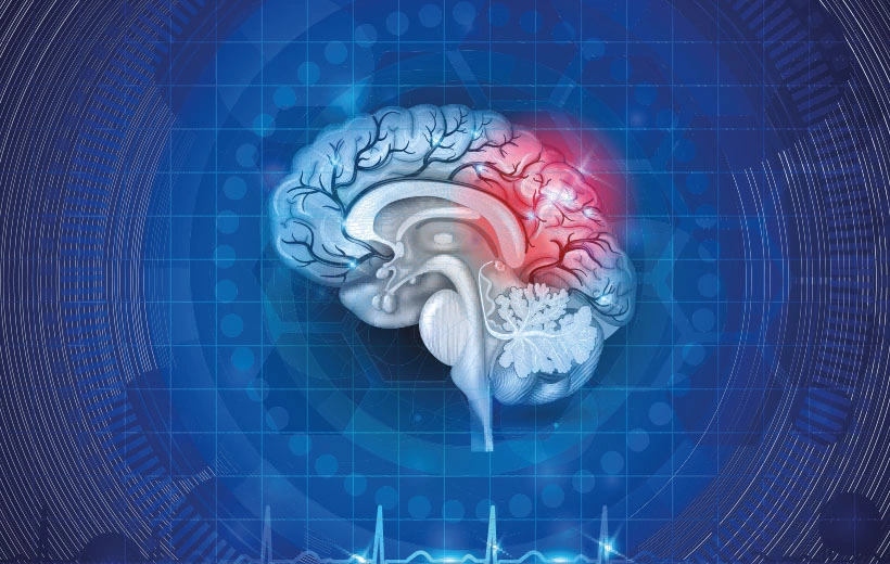 Астроцитома: симптомы, лечение, прогноз