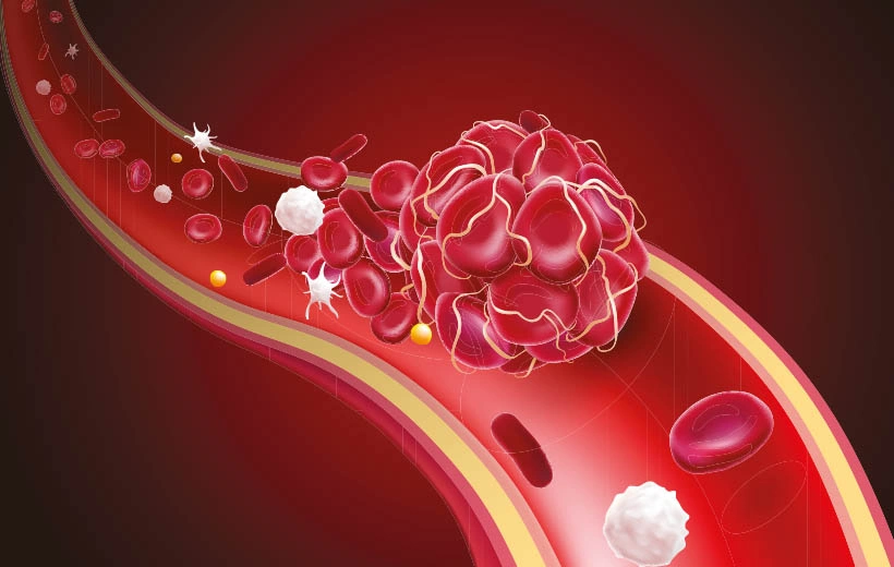 Талассемия: симптомы, диагностика, лечение Талассемия: симптомы, диагностика, лечение