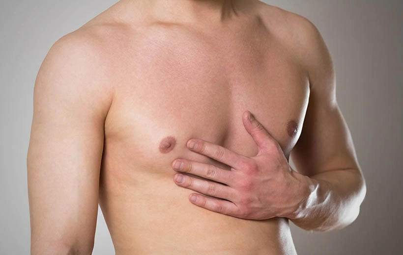 Гинекомастия: причины и лечение (операция)