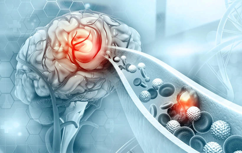 Аортальная недостаточность: симптомы, степени, лечение