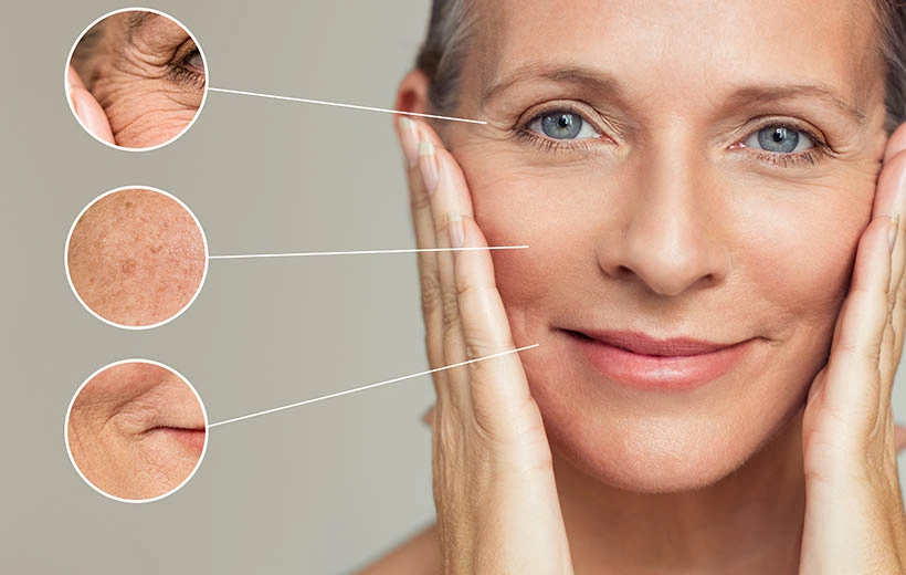 Морщины: причины, признаки, как убрать