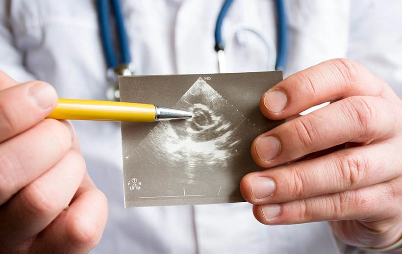 Митральная недостаточность: степени, симптомы, лечение