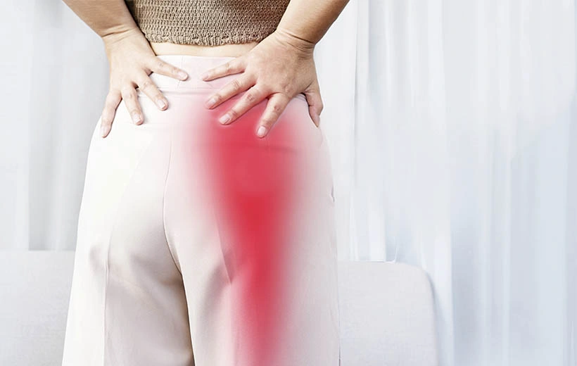 Ишиас: причины, симптомы, лечение